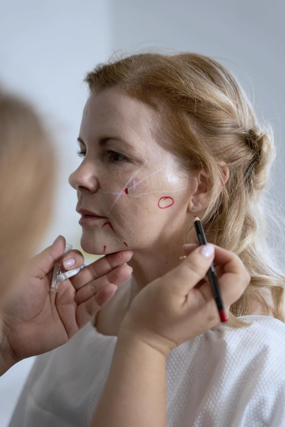 Dr Tania marks support points on the cheek and jawline of a patient in her 50s before treatment