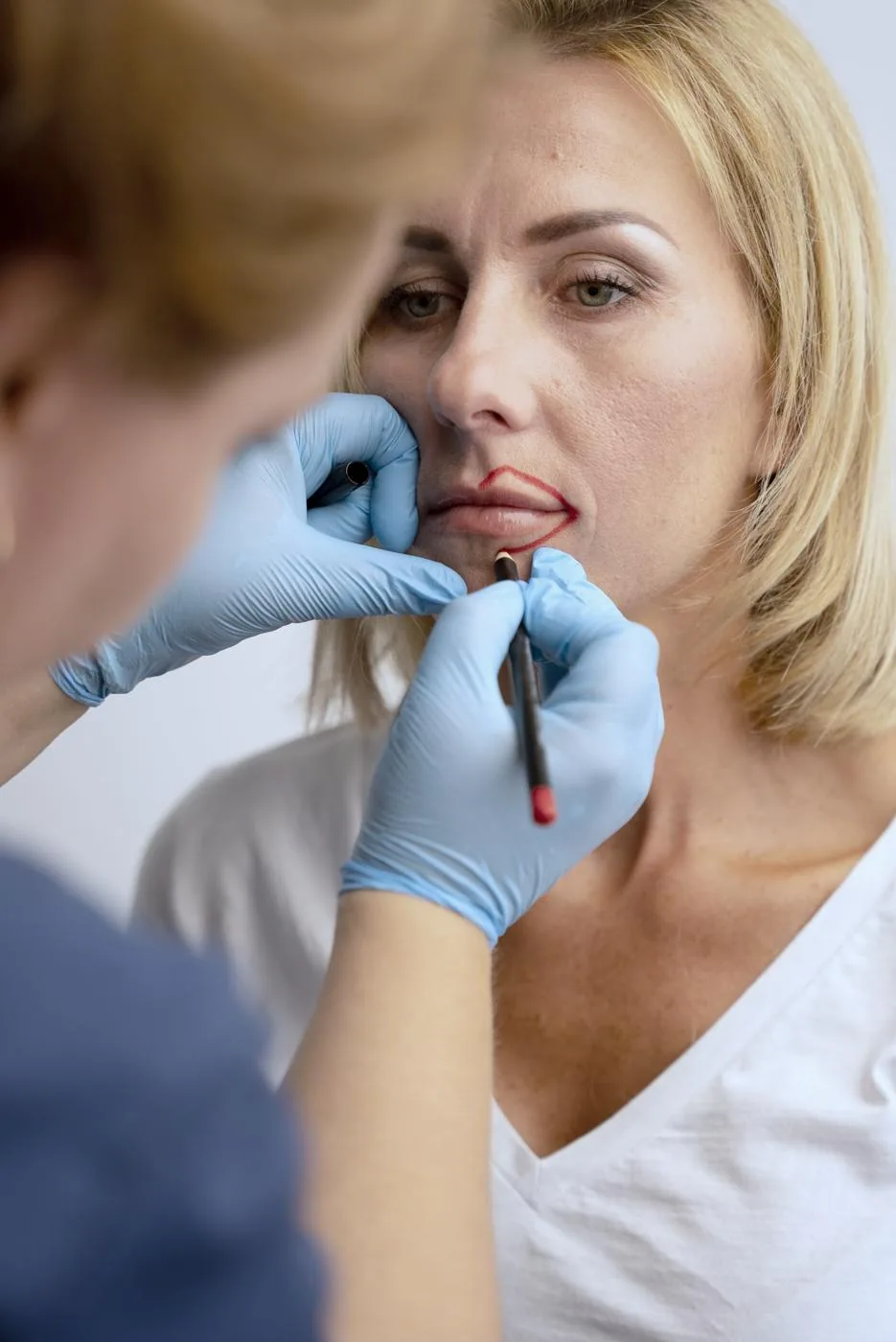 Dr Tania marks the natural outline of a patient's lips with a white pencil before treatment