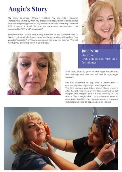 Angie's patient story — cosmetic medicine Birchington