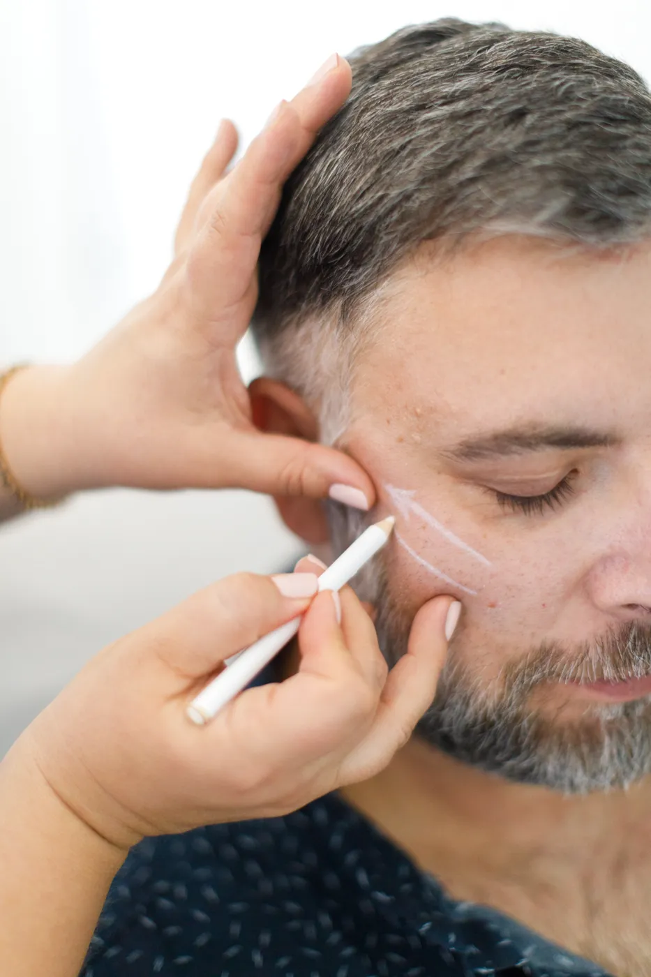 Dr Tania mapping the cheek and jawline of a male client before treatment, Cosmetic Medicine Birchington
