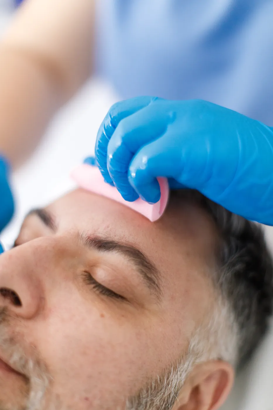 Medical-grade skin peel treatment at Cosmetic Medicine Birchington